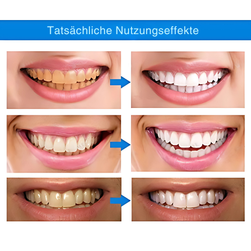 RadianceRush™ Whitening Pen — Reveal a Radiant Smile That Commands Attention Instantly