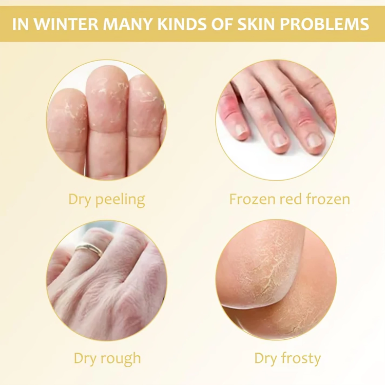 RamiraPure™ — Transform Dry, Cracked Skin into Silky-Soft Confidence Every Day