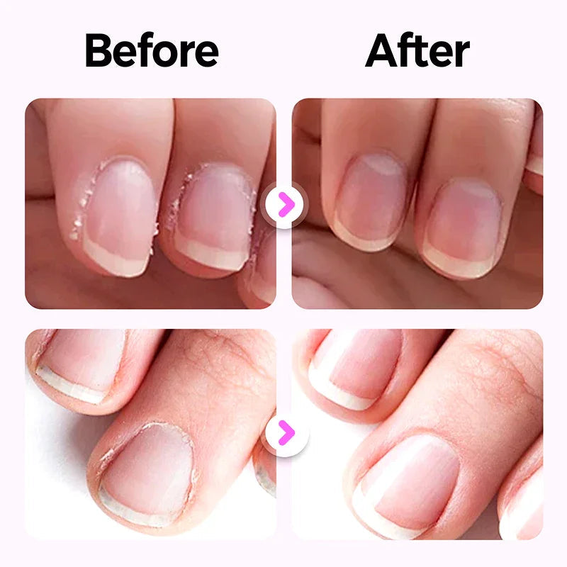 SilqueNail™ Pen — Transform Your Nails Into a Stunning Statement of Strength and Beauty