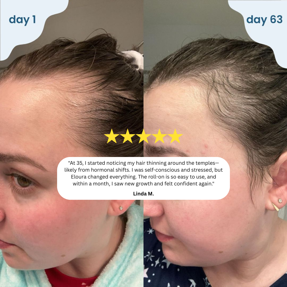 CrownMist™ — Unlock Fuller, Thicker Hair That Boosts Your Confidence Every Day