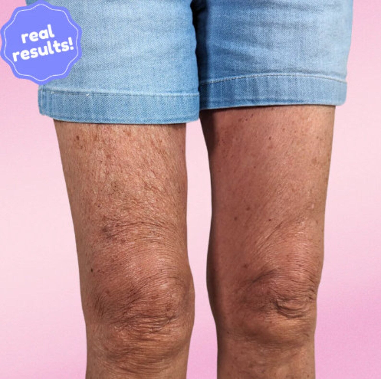 VeloraLift™ — Instant Invisible Lift for Skin That Feels Tight, Smooth, and Unstoppable