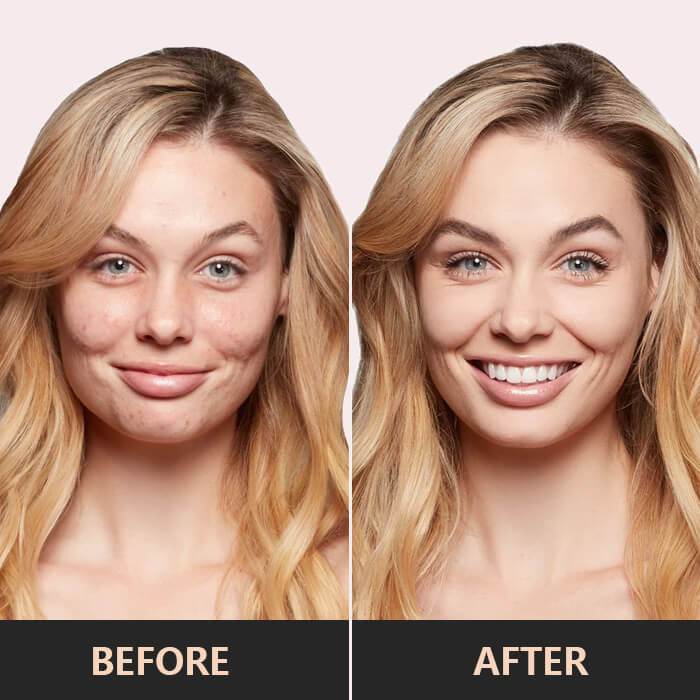 GlowAura™ CC Cream — Flaunt Fresh, Flawless Skin That Radiates Confidence All Day