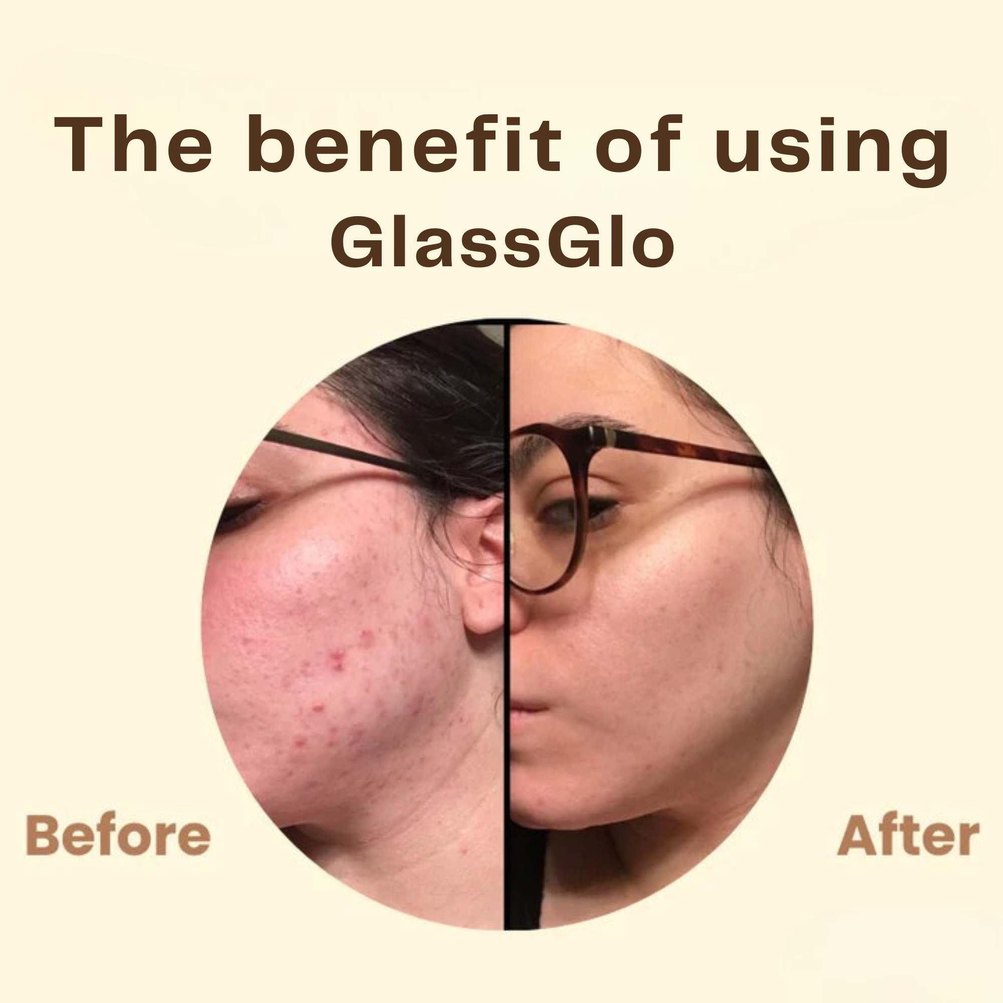 LumeaSilk™ — Unlock Irresistibly Smooth, Radiant Skin from the First Peel