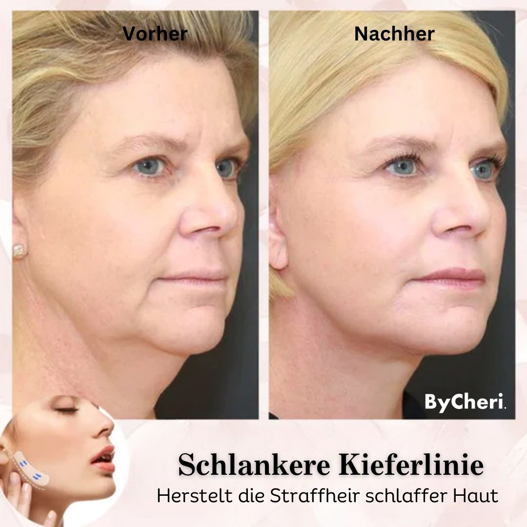 Buy One Get One Free Today | 2025 Invisible Face Lifting Band Set
