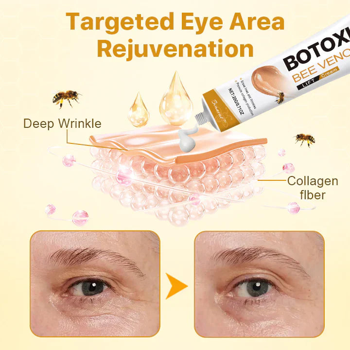 Buy One Get One Free Today | Botox Treatment