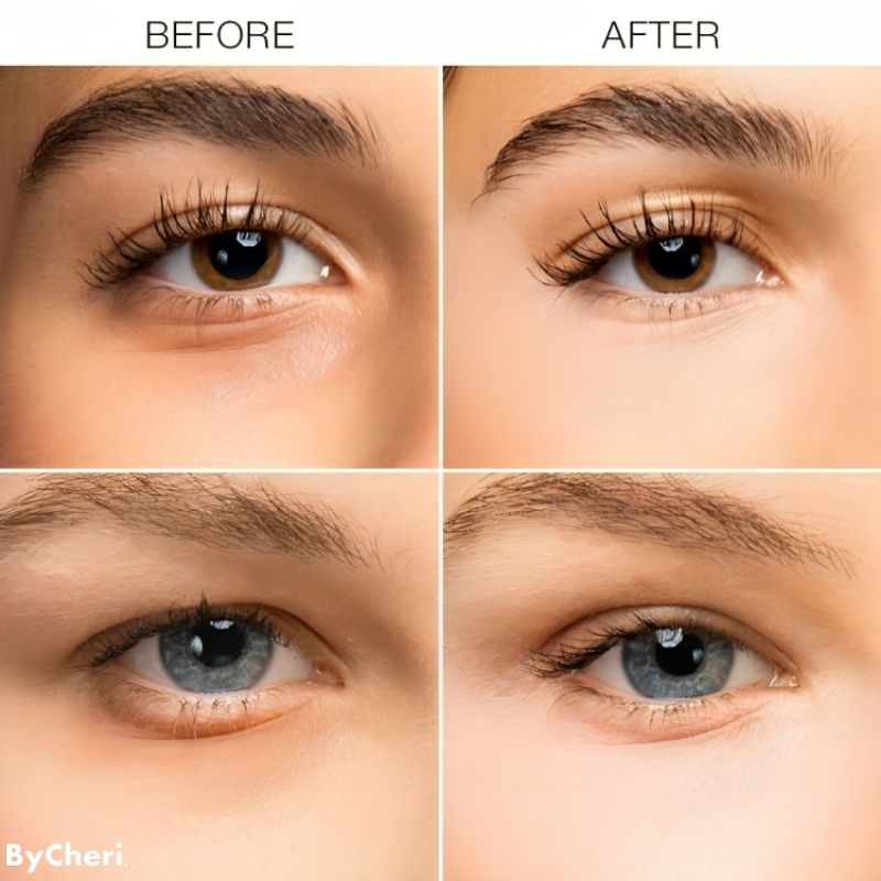 Buy One Get One Free Today | Brightening Eye Cream for Dark Circles