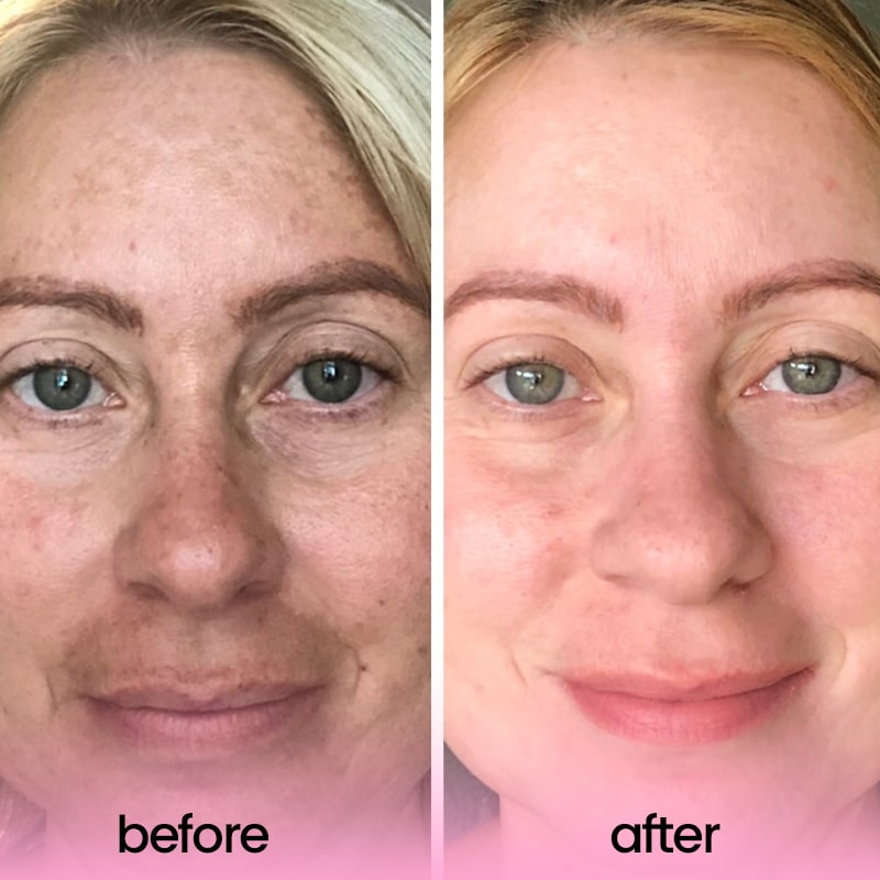 Buy One Get One Free Today | Glow Booster | Radiant Skin with One Use!