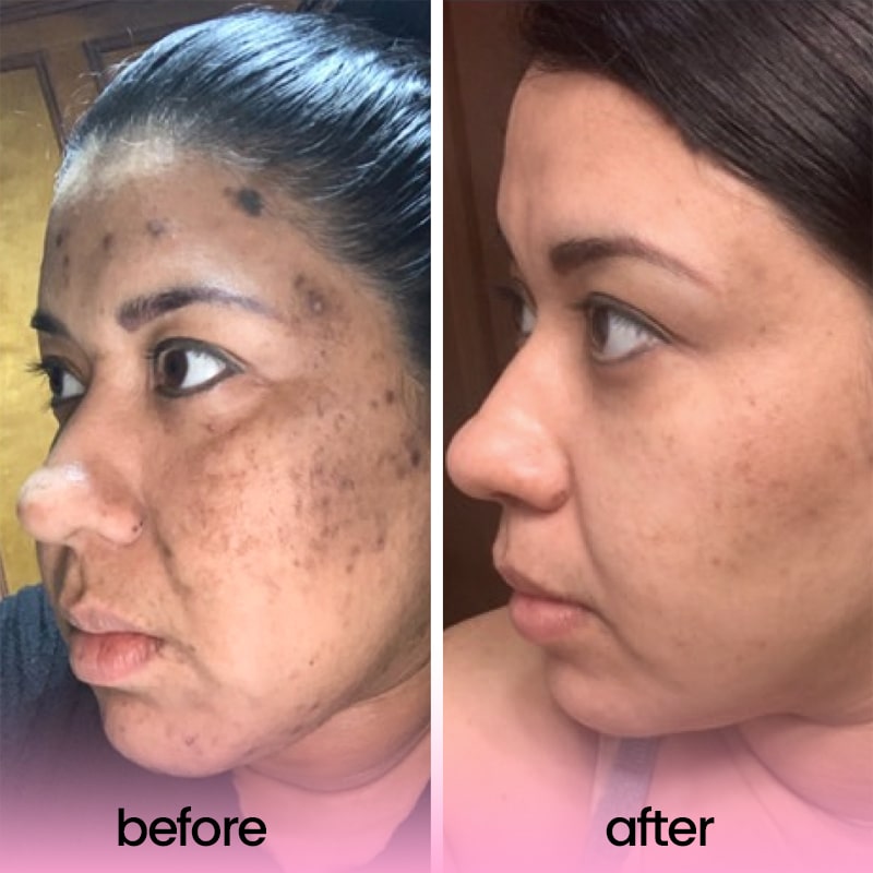Buy One Get One Free Today | Glow Booster | Radiant Skin with One Use!
