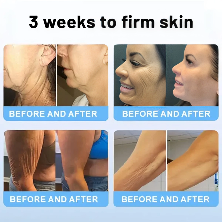 Buy One Get One Free Today | RevitaStick | Your Secret for Firmer, More Elastic Skin!