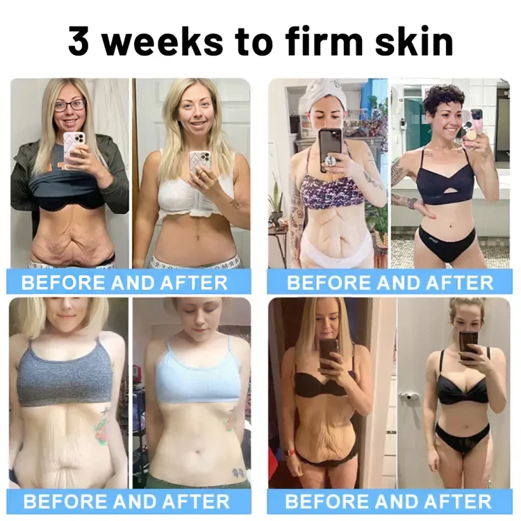 Buy One Get One Free Today | RevitaStick | Your Secret for Firmer, More Elastic Skin!