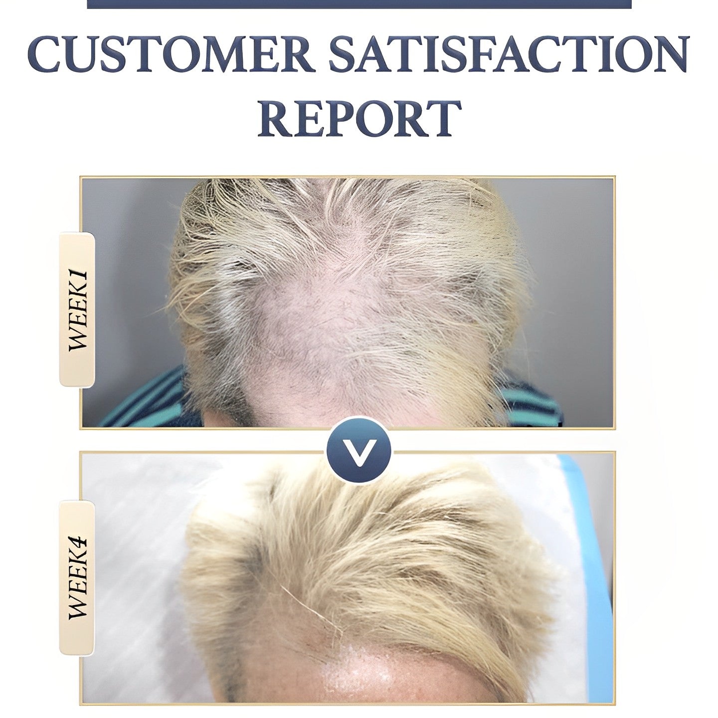 Buy One Get One Free Today | Anti-Hair Loss Rice Shampoo Bar