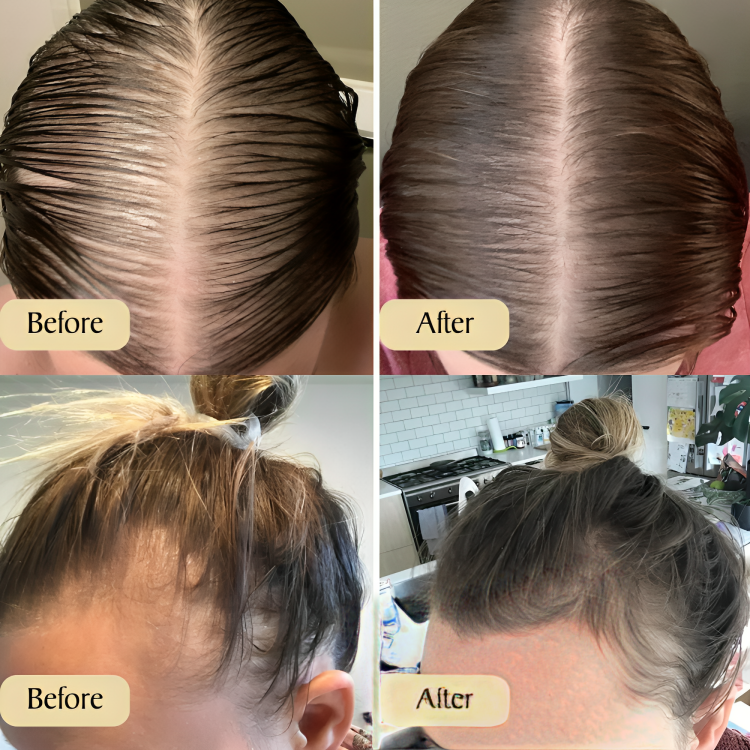 Buy One Get One Free Today | Enjoy Beautiful & Healthy Hair!