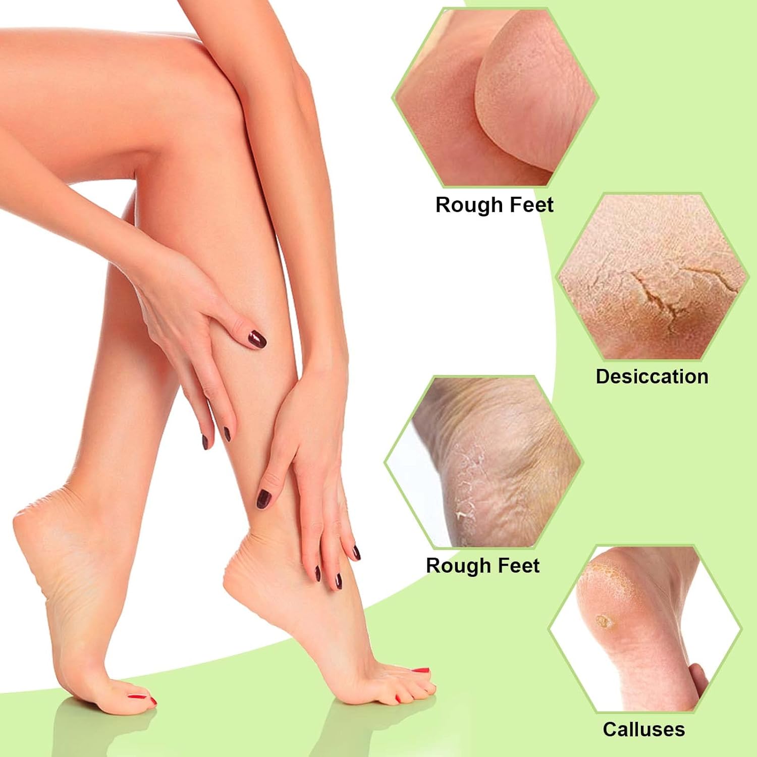 Buy 1 Get 2 Free Today | HydraFeet | Say Goodbye to Cracked Heels!