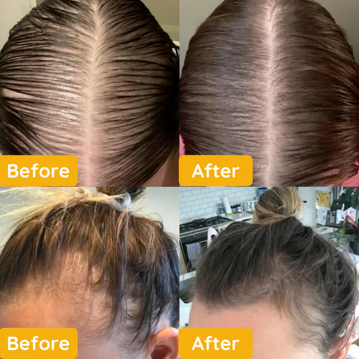 Get 1 Free | Naturally Wake Up to Thicker, Stronger Hair
