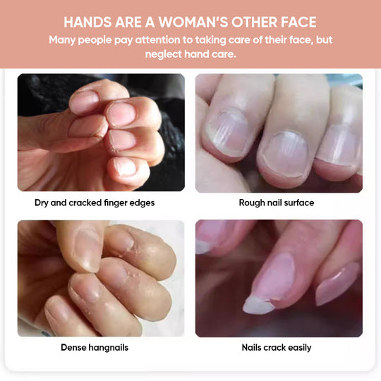 Buy One Get One Free | Nutritional Nail Growth Oil for Stronger, Healthier Nails