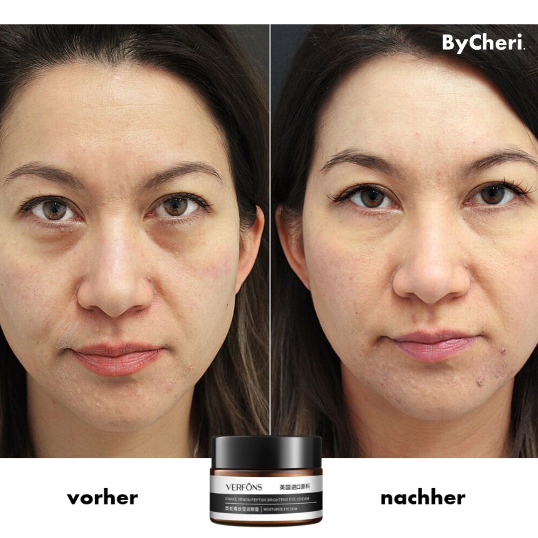 Buy One Get One Free | Anti-Wrinkle Eye Cream for Rejuvenation