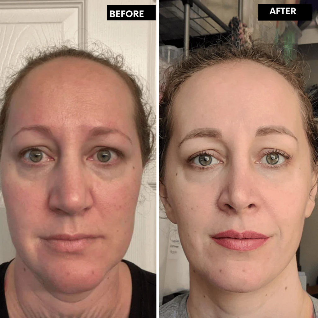 RadianceLift™ — Unleash Youthful Glow and Firm, Silky Skin in Just Two Weeks