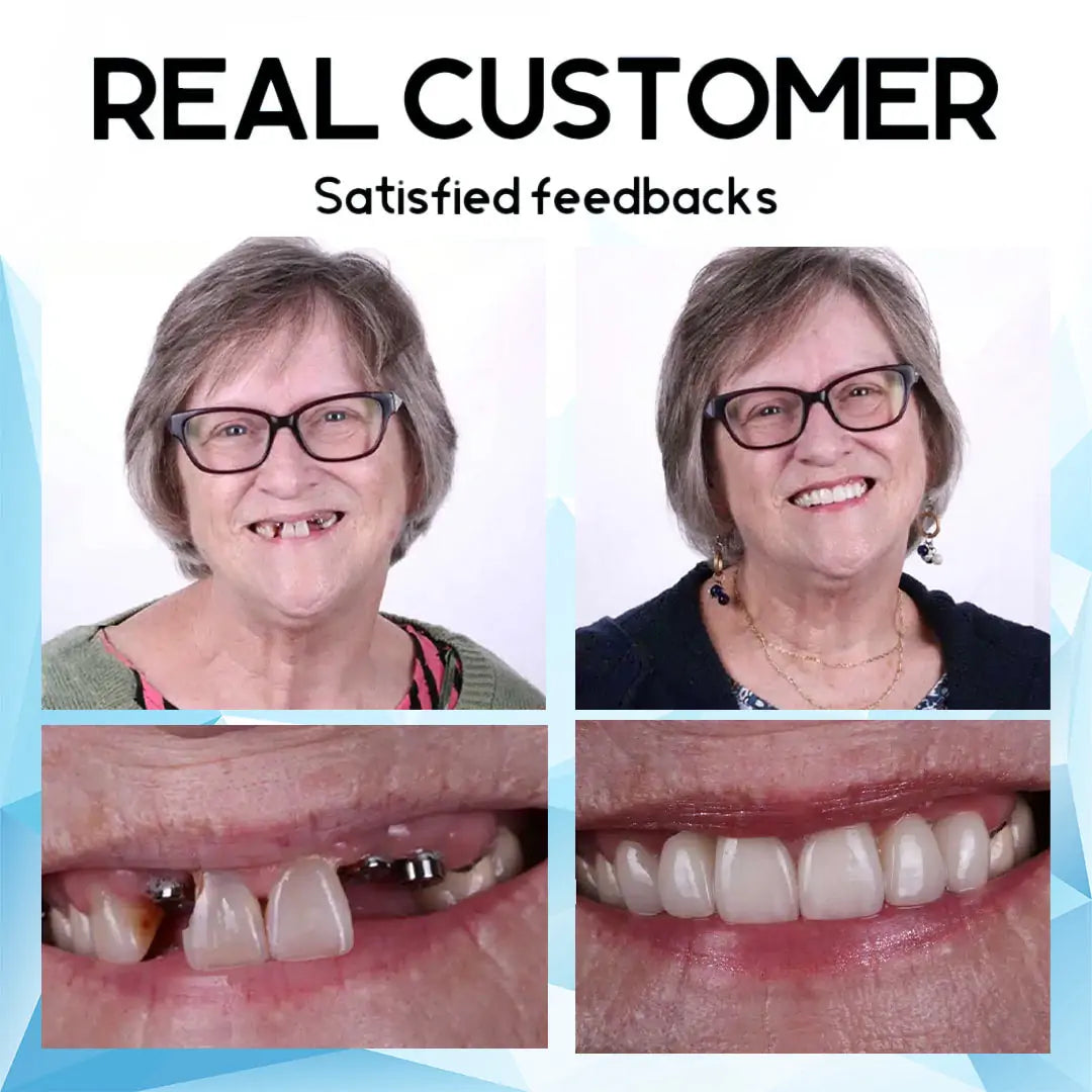 RadiantRise™ — Smile Boldly with Comfort and Confidence All Day Long