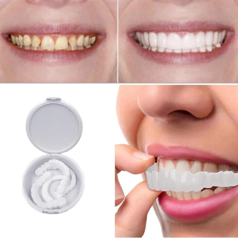 GlideSmile™ — Snap On a Stunning Smile That Turns Heads Instantly