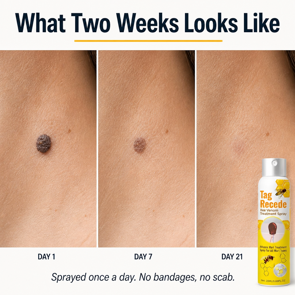 VenomaSilk™ — Effortlessly Eliminate Stubborn Warts with Bee Venom and Salicylic Acid Spray