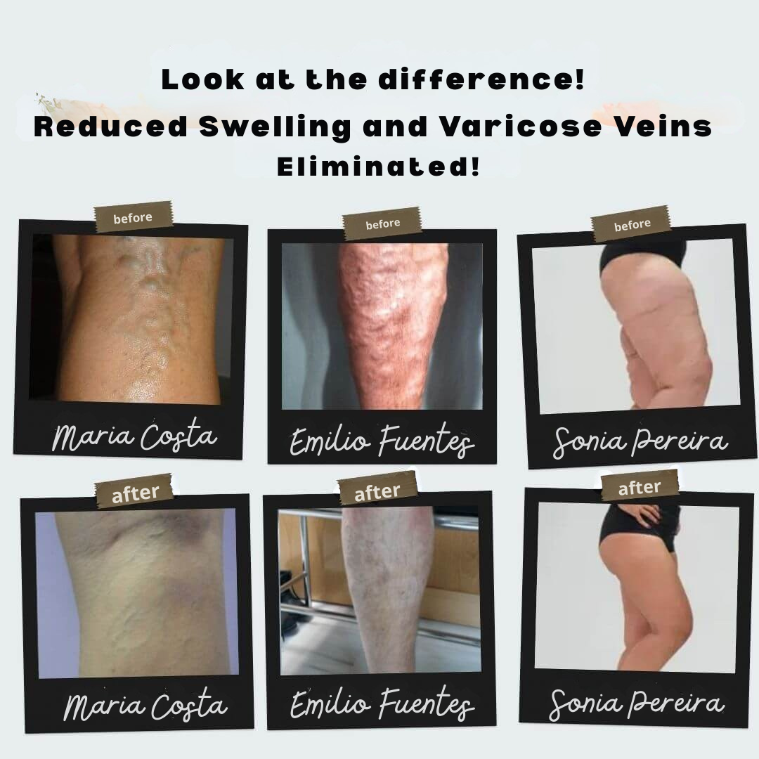 CircuEase™ — Instantly Revive Tired Legs with Soothing Warmth and All-Day Comfort