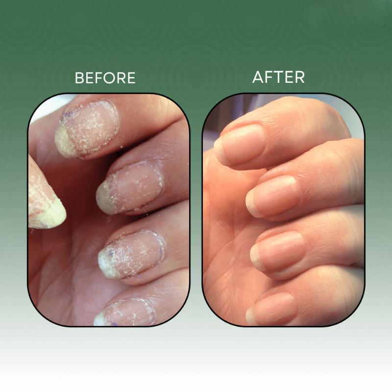 VitaNail™ — Unleash Rock-Solid Nails That Boost Your Confidence Every Day
