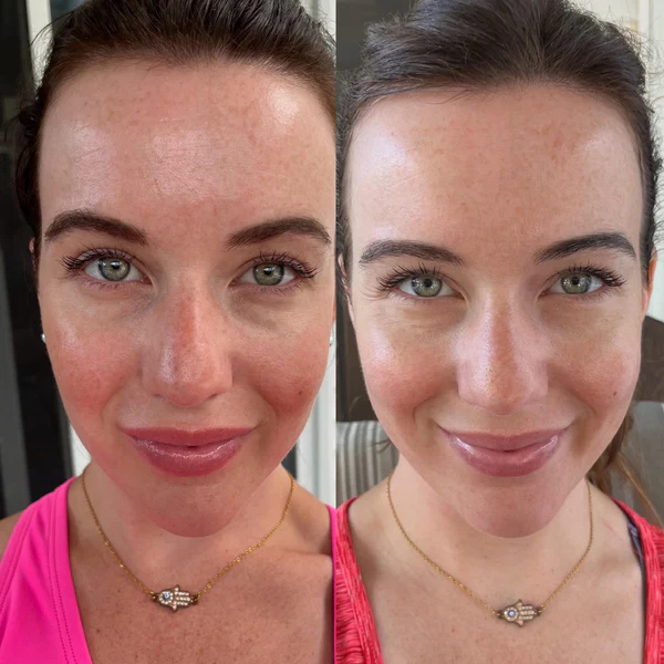 LumiLuxe™ — Unlock Your Glow with Youthful, Radiant Skin Every Day