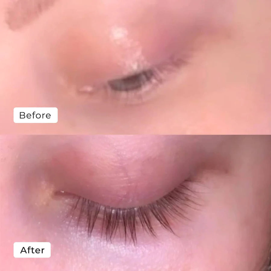 LashAura™ — Wake Up to Stunning, Full Lashes in Just 7 Days