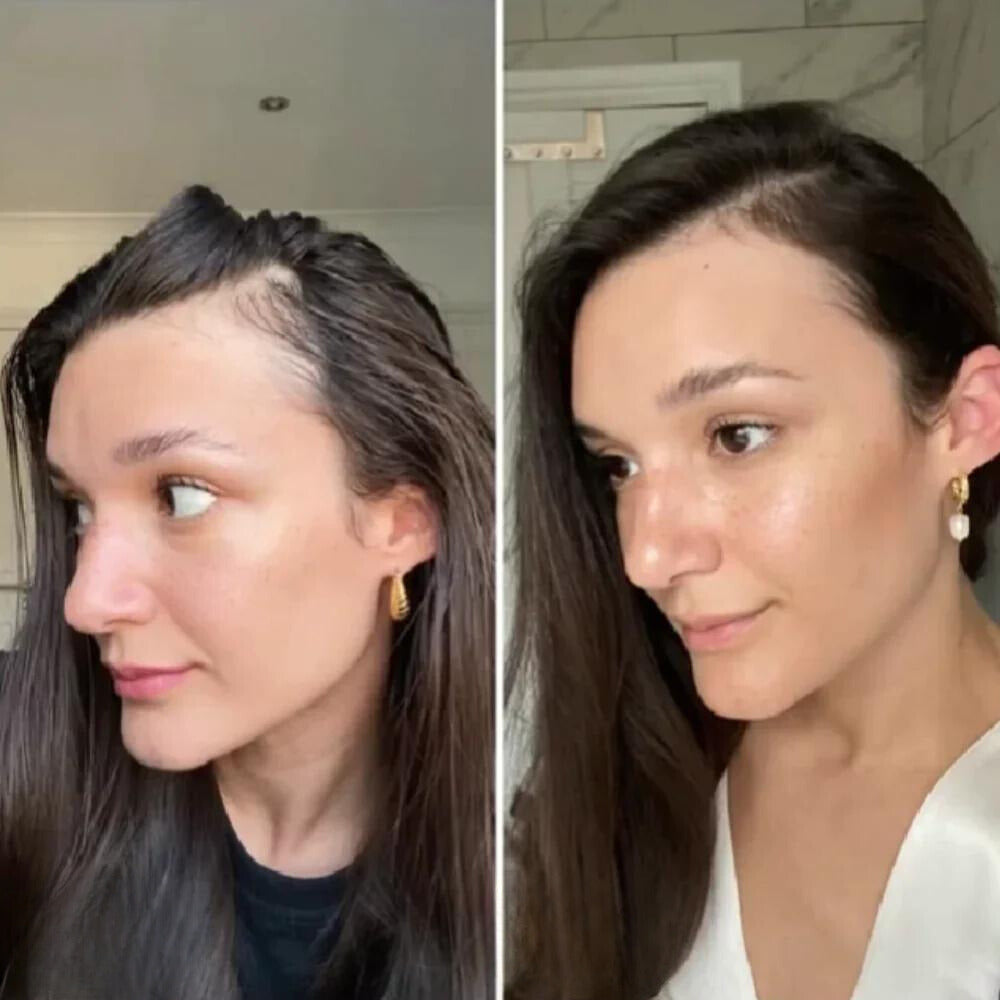 ElevaVive™ — Unlock Rich, Full-Bodied Hair That Commands Attention