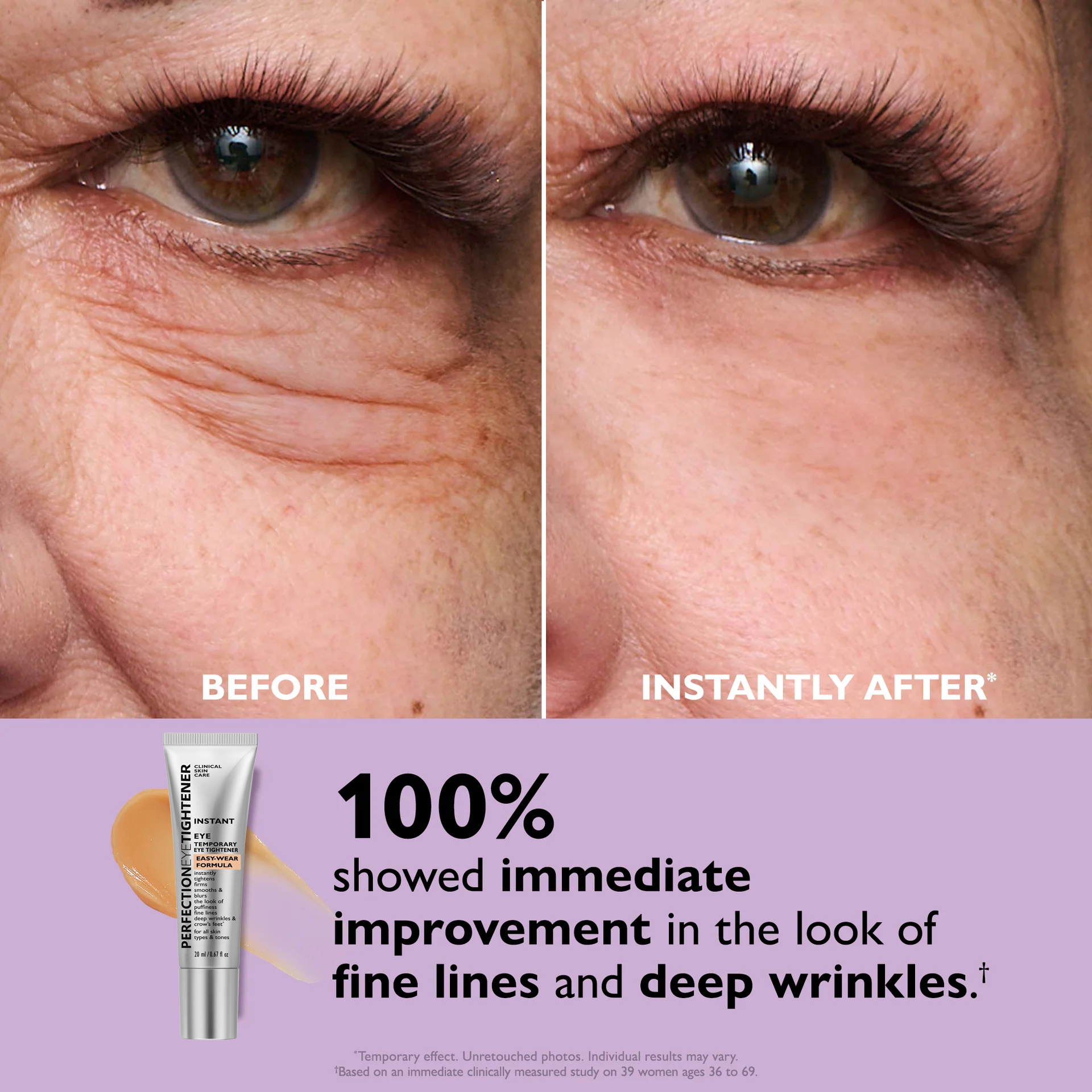 LumaLift™ — Instantly Revive Tired Eyes with a Youthful, Radiant Glow