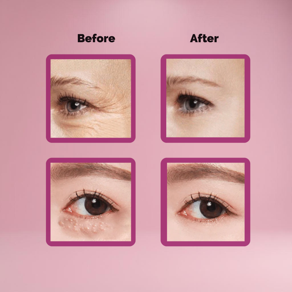 RadianceLift™ — Instantly Erase Puffy, Tired Eyes for a Youthful, Energized Glow