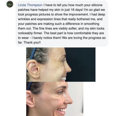 Arvilaro™ - Silicone Scar Sheets