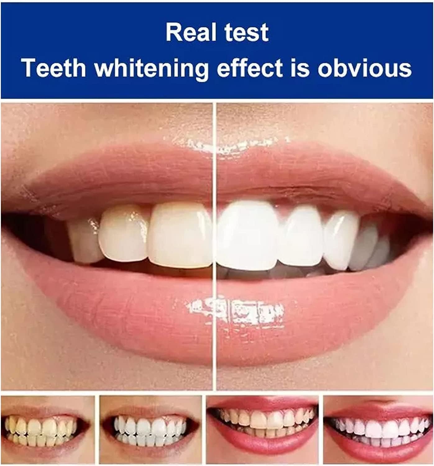 GlowCrest™ — Ignite Confidence with a Radiant, Healthy Smile Every Day