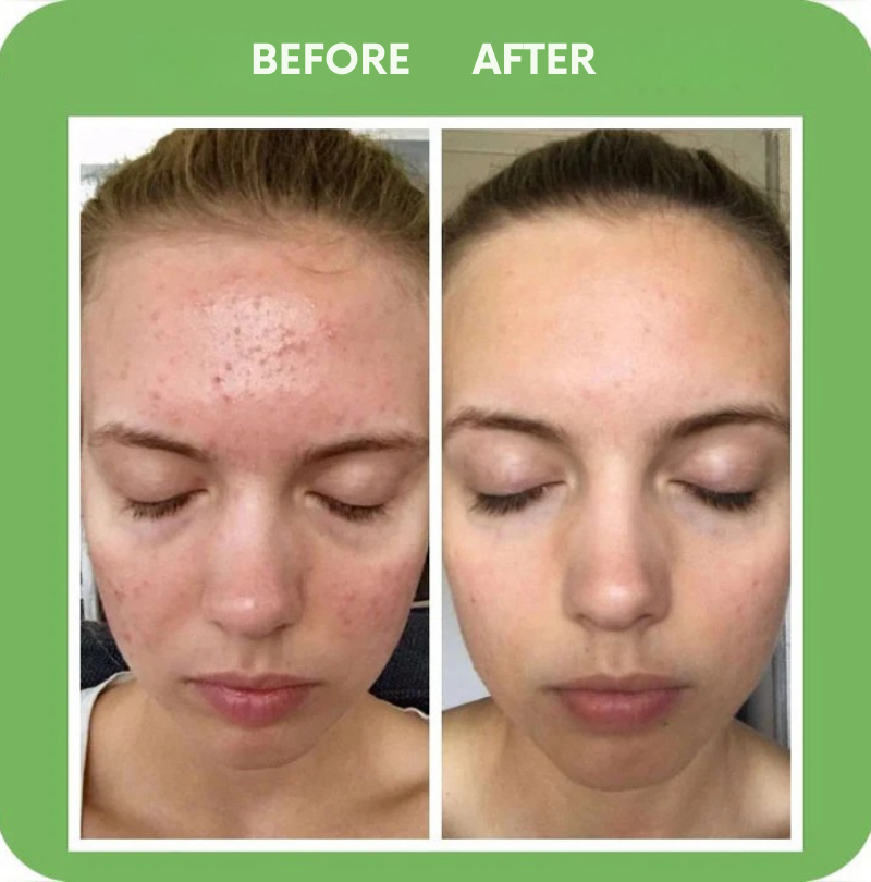 VerdantiFlourish™ — Unleash Radiant, Clear Skin That Commands Every Mirror and Moment