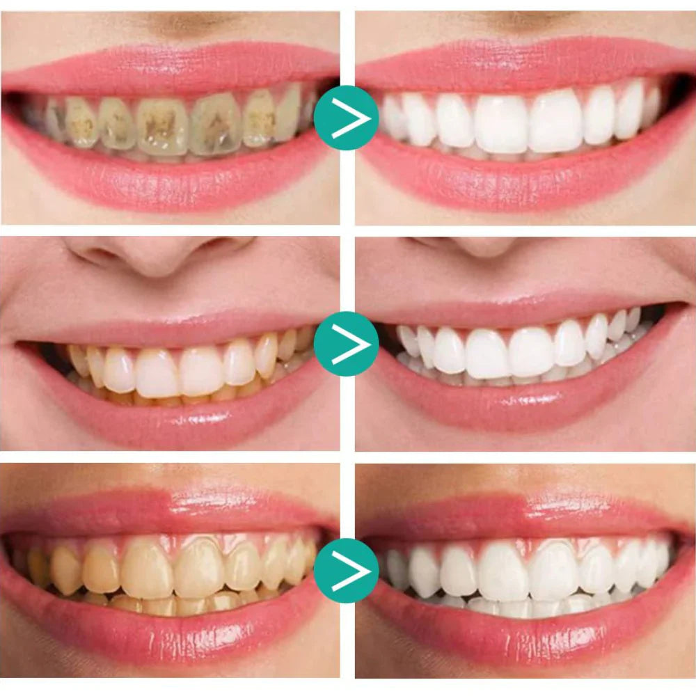 RadianceFoam™ — Unleash a Radiant Smile That Commands Attention Instantly