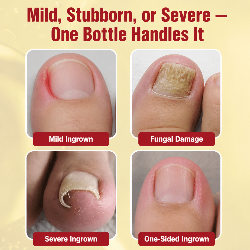 NailFortify™ — Ease Discomfort from Ingrown Toenails and Fungal Harm at Home