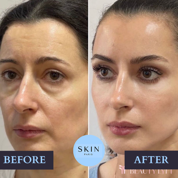 GloraLift™ — Reveal Radiant, Youthful Skin That Turns Heads Every Day