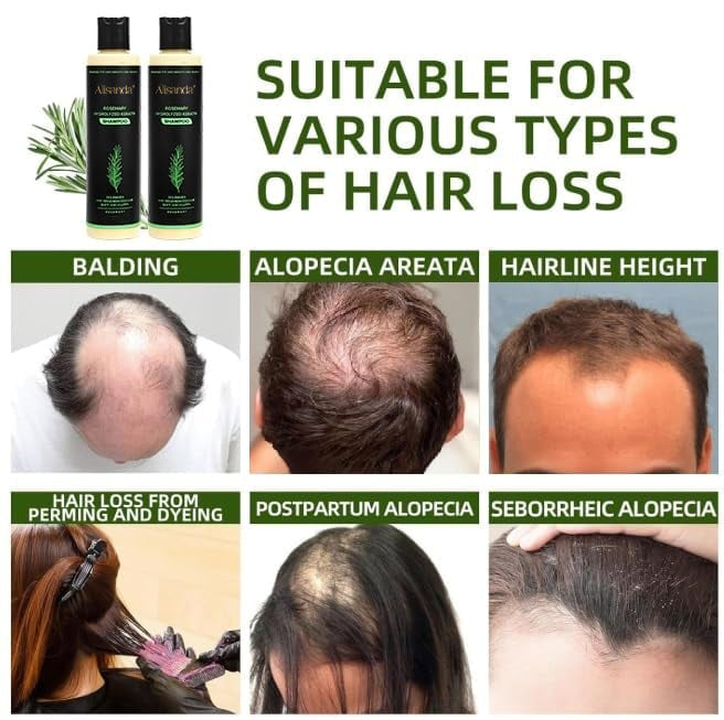 StrandiVive™ Shampoo — Unlock Thick, Lush Hair That Boosts Your Confidence Every Day