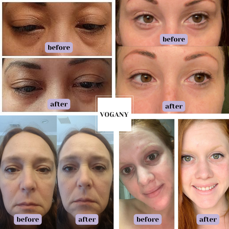RamoraLux™ — Melt Away Eye Wrinkles and Feel Recharged in Minutes