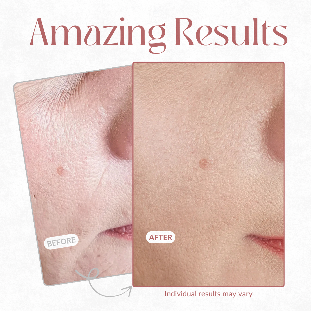 LumaFirm™ — Unleash Your Skin’s Instant Lift and Lasting Radiance