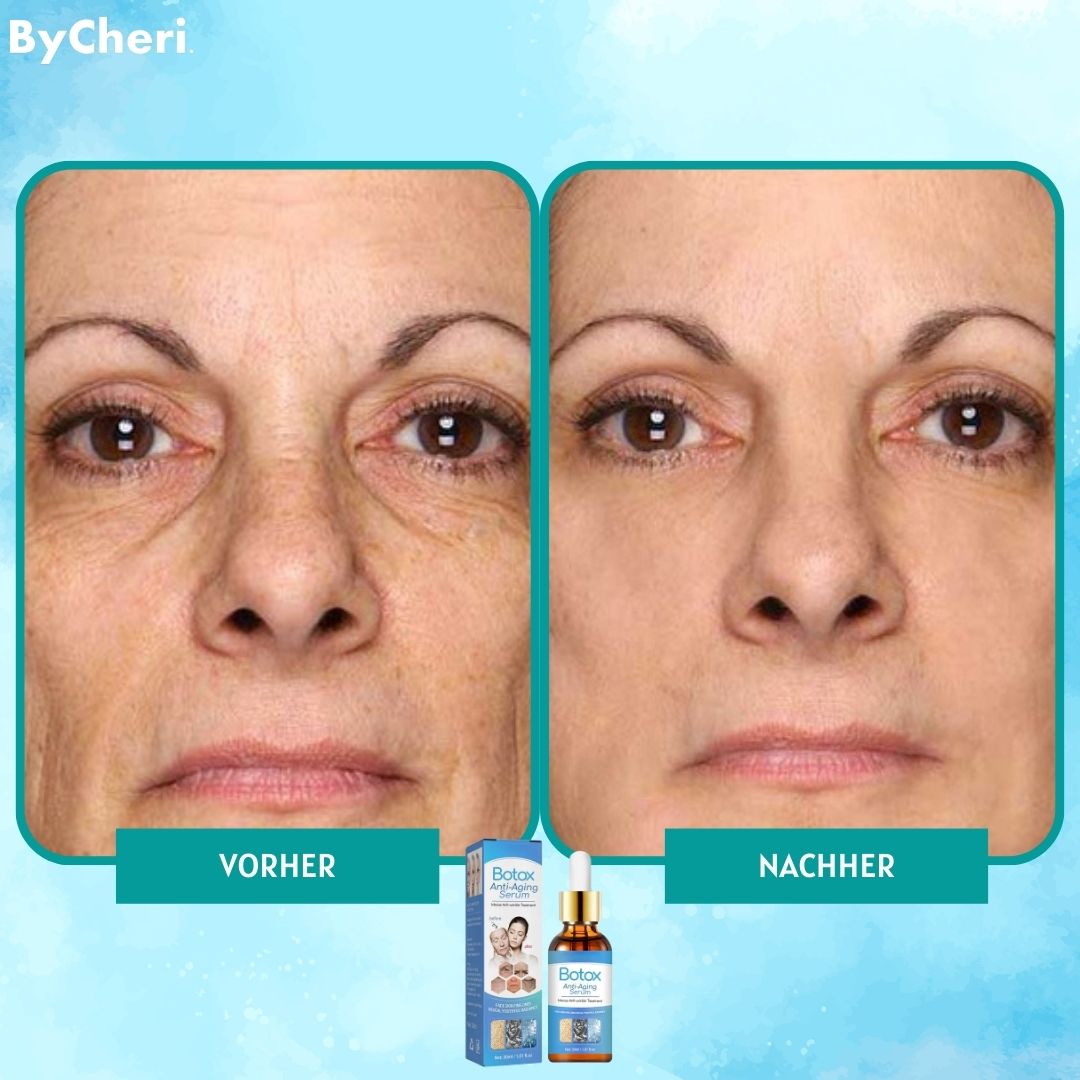 VitaLuxe™ — Unlock Radiant, Youthful Skin Without Needles or Pain