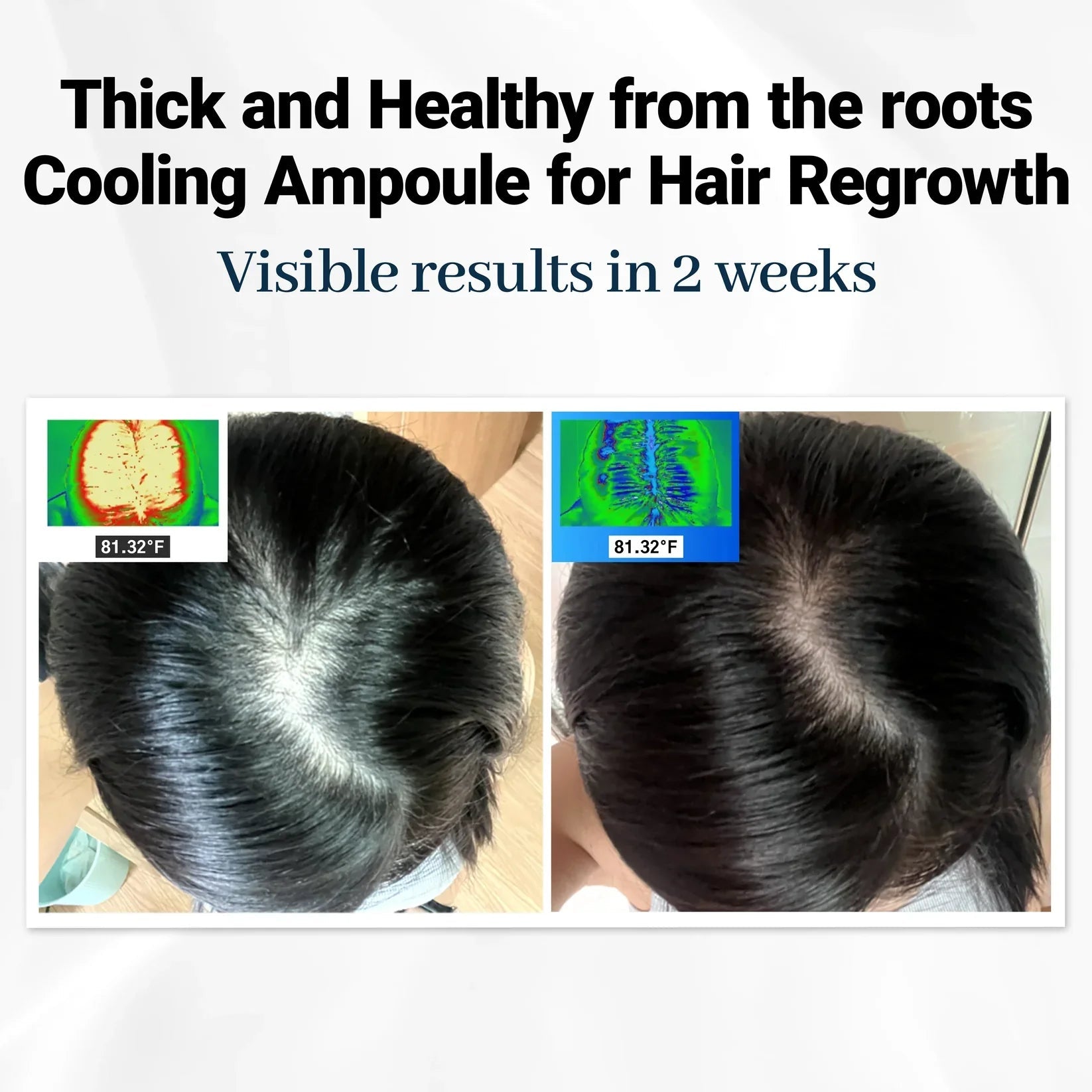 Berelli Hair Growth Scalp Ampoule™ — Unlock Thick, Strong Hair That Turns Heads Fast