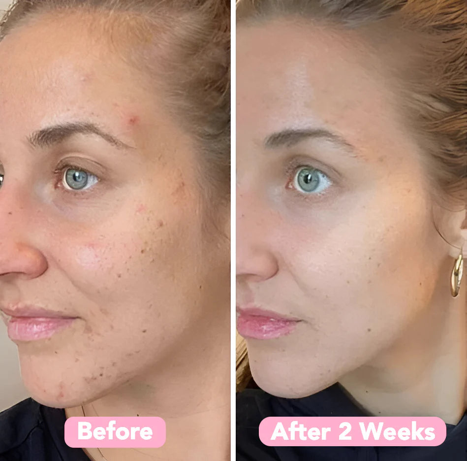 LumiFleur™ Radiance Pads — Wake Up to Instantly Brighter, Smoother, Spotless Skin