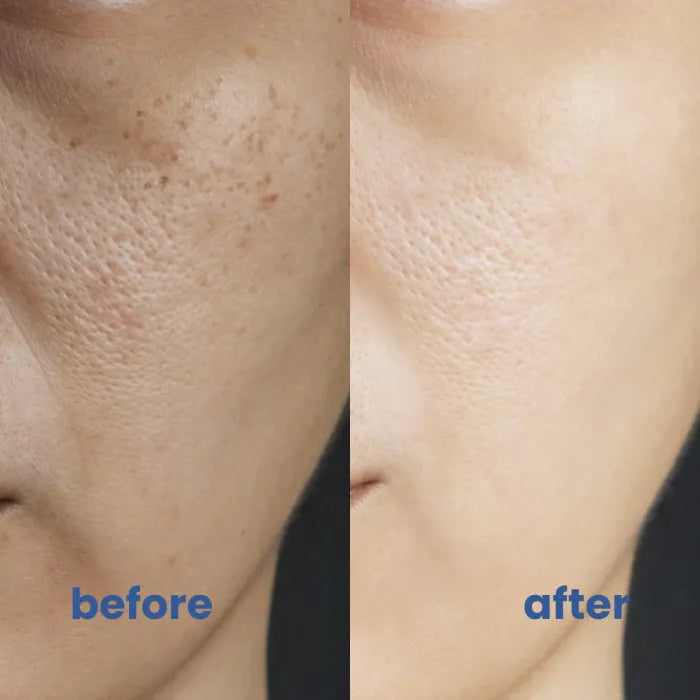 LumaVeil™ — Unlock Radiant, Flawless Skin That Heals and Glows All Day