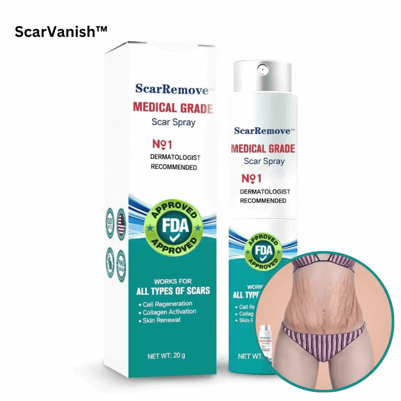 ScarDiminish™ 100 Advanced Scar Remedy Spray — Watch Scars Disappear and Confidence Skyrocket in Weeks