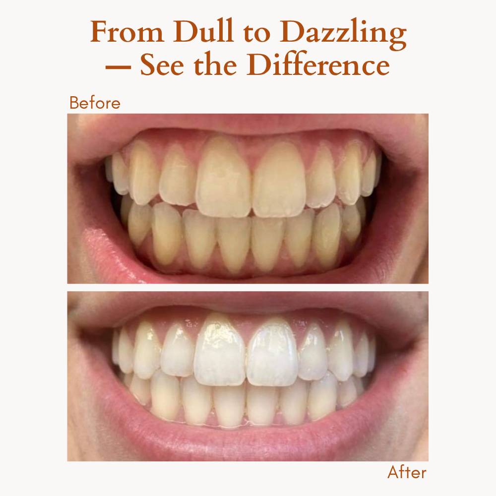 DiamondShine™ Whitening Pen — Unleash a Radiant Smile That Commands Attention Instantly