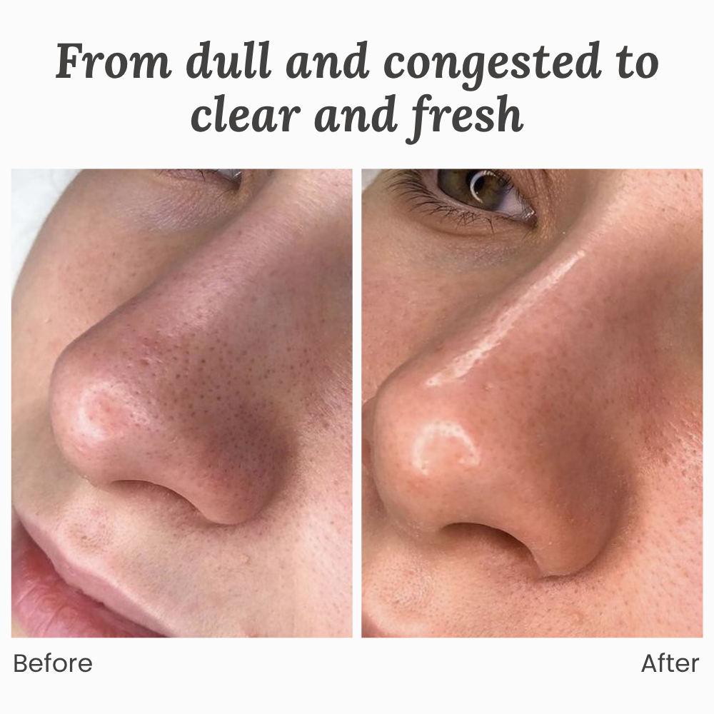 GlowRenew™ — Unlock Your Skin’s Natural Glow and Feel Radiant Every Day