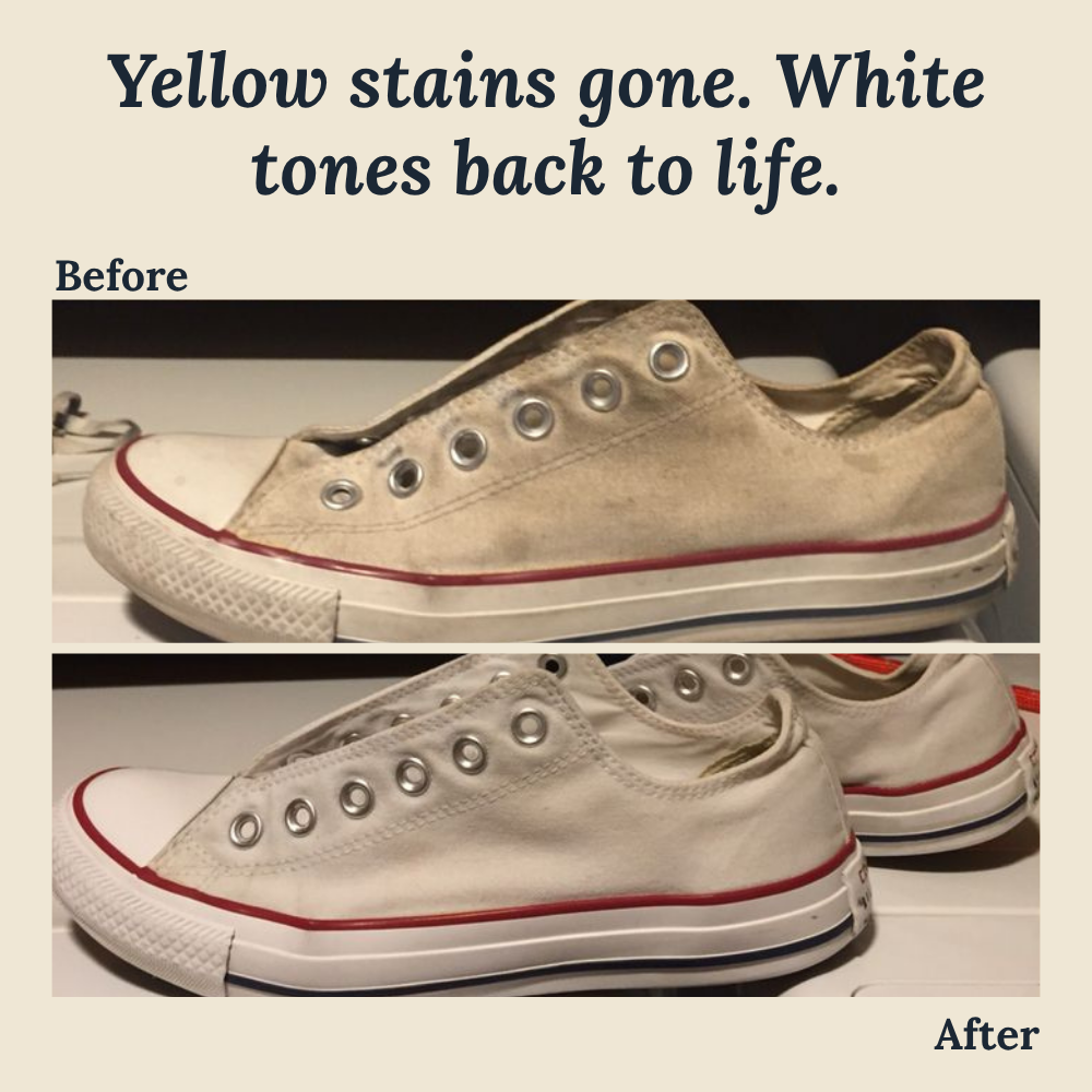 SoleReboot™ — Instantly Restore Your Sneakers to Showroom Freshness