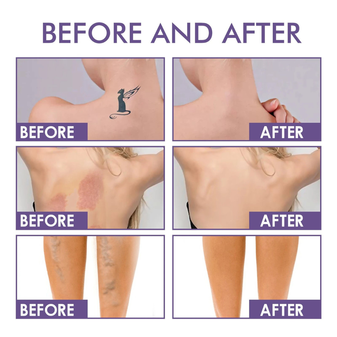 50% Off Temporary | Flawless Skin in Seconds - No Filters Needed!