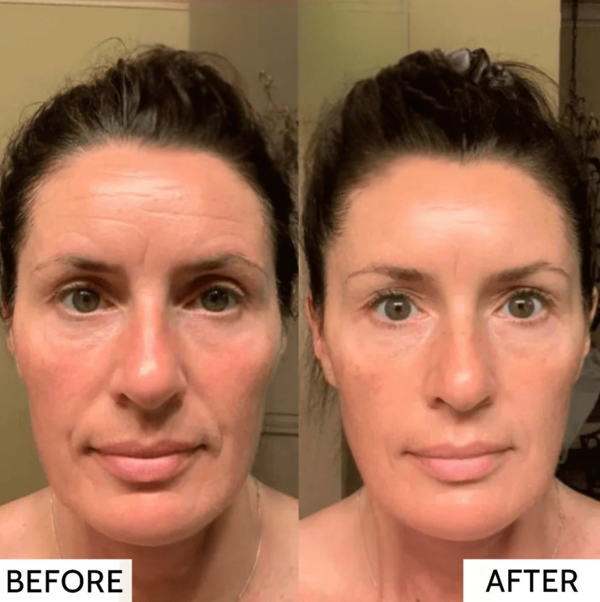 50% OFF TEMPORARY | RevitaMask | Experience Firm and Radiant Skin!